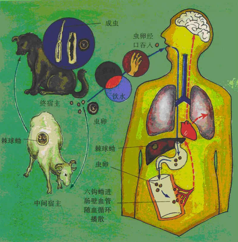 圖01肝包蟲發(fā)病機(jī)制.png